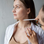 Laserowe usuwanie pieprzyków