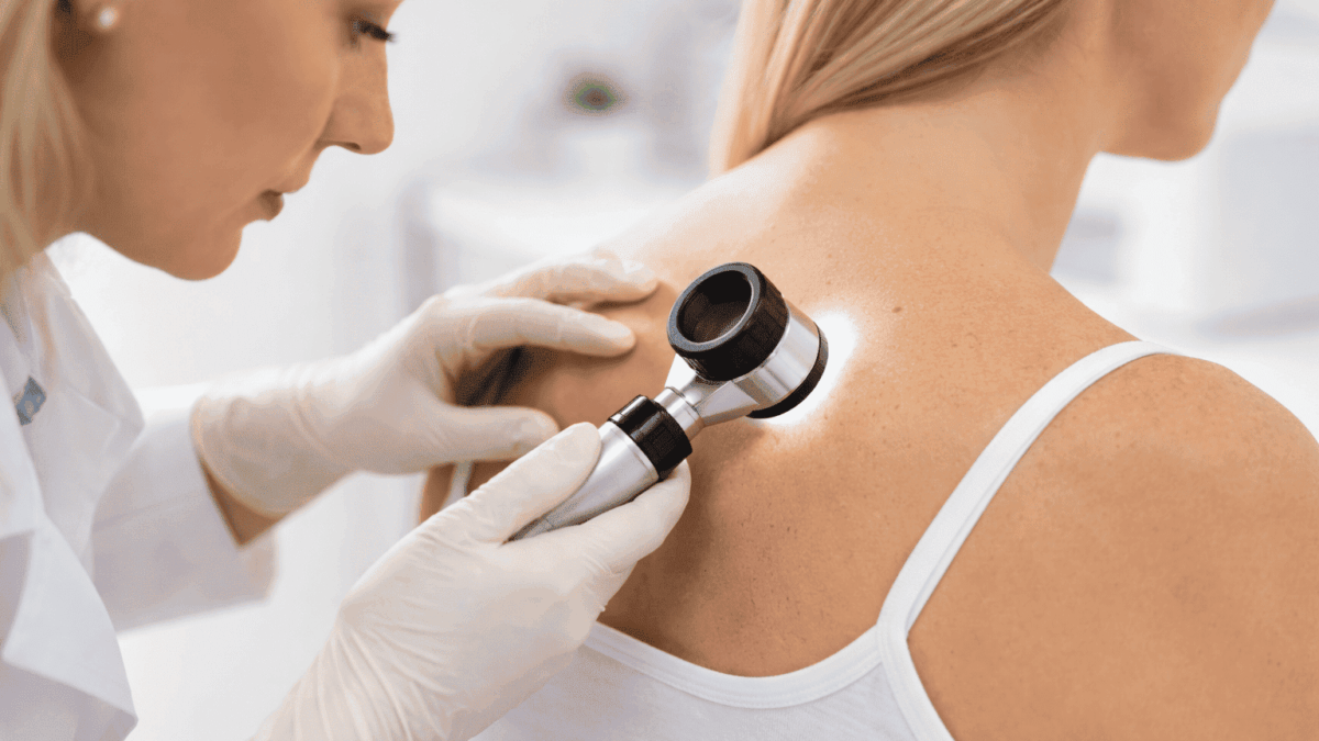 Dermatoskopia w diagnostyce zmian skórnych